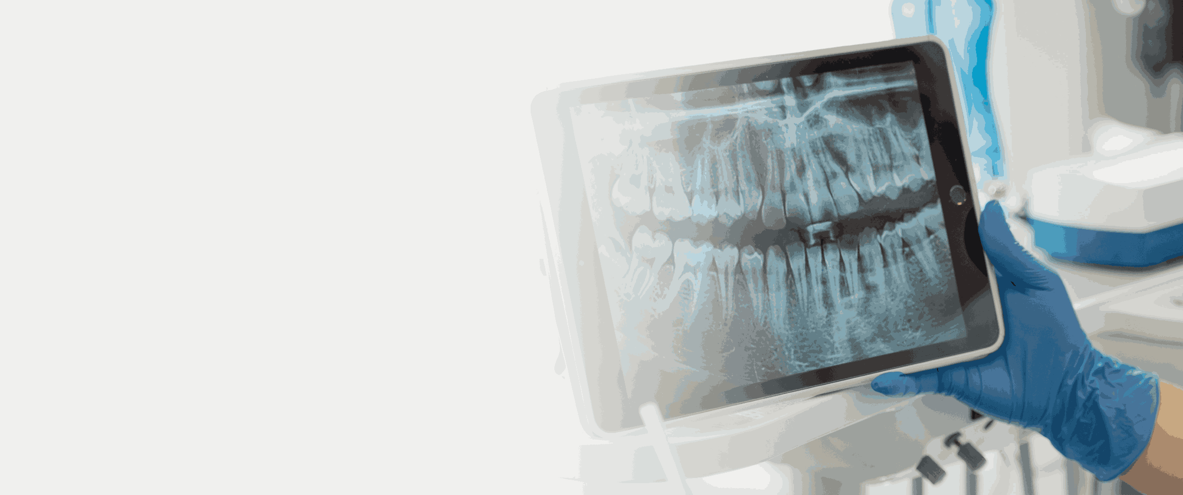 Yapay Zeka Destekli Dental Uygulamanın Benimsenmesi: Diş Sağlığında Bir Devrim