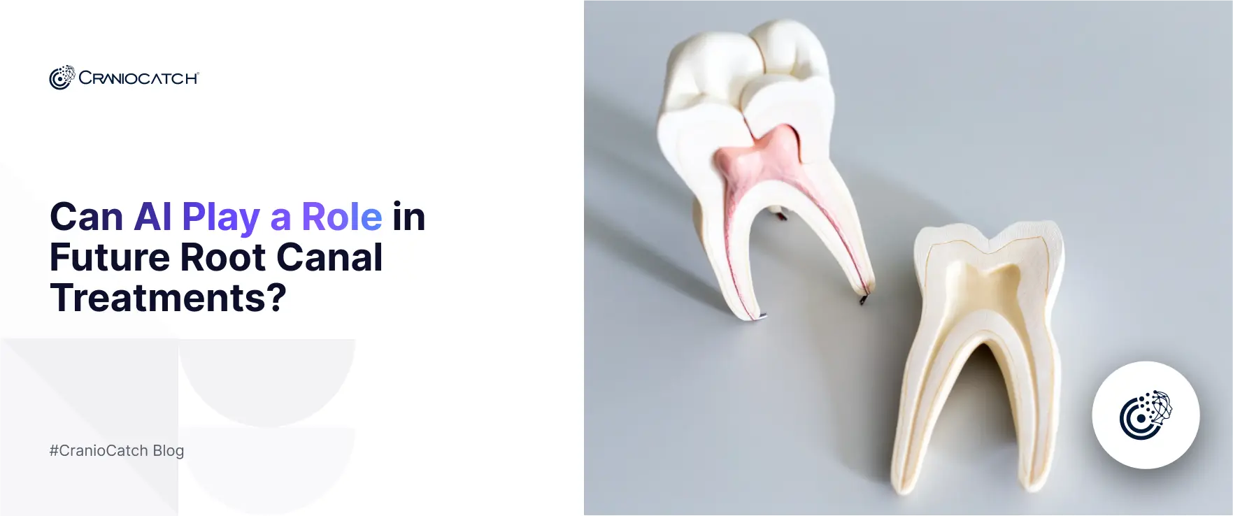 The Future of Root Canal Treatment: Can Artificial Intelligence Transform It?