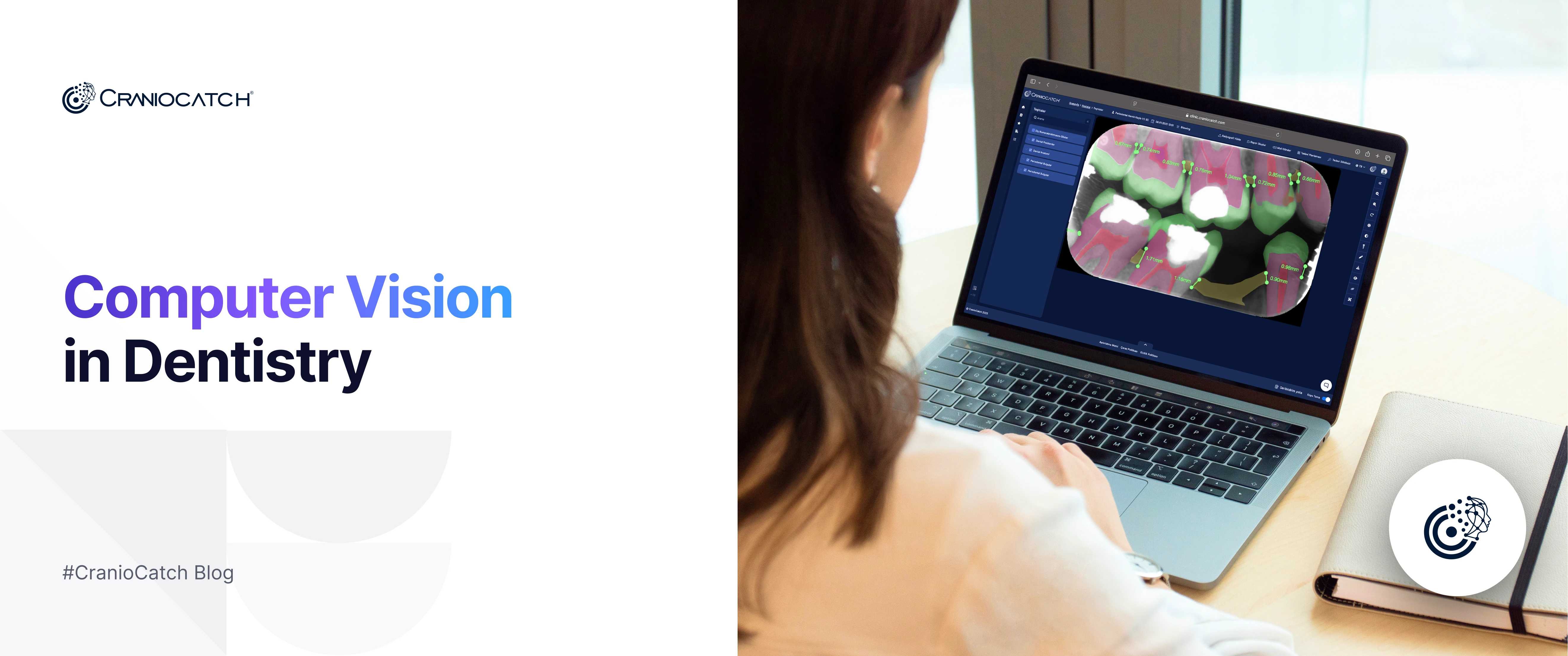 Computer Vision in Dentistry: The Future of Dental AI