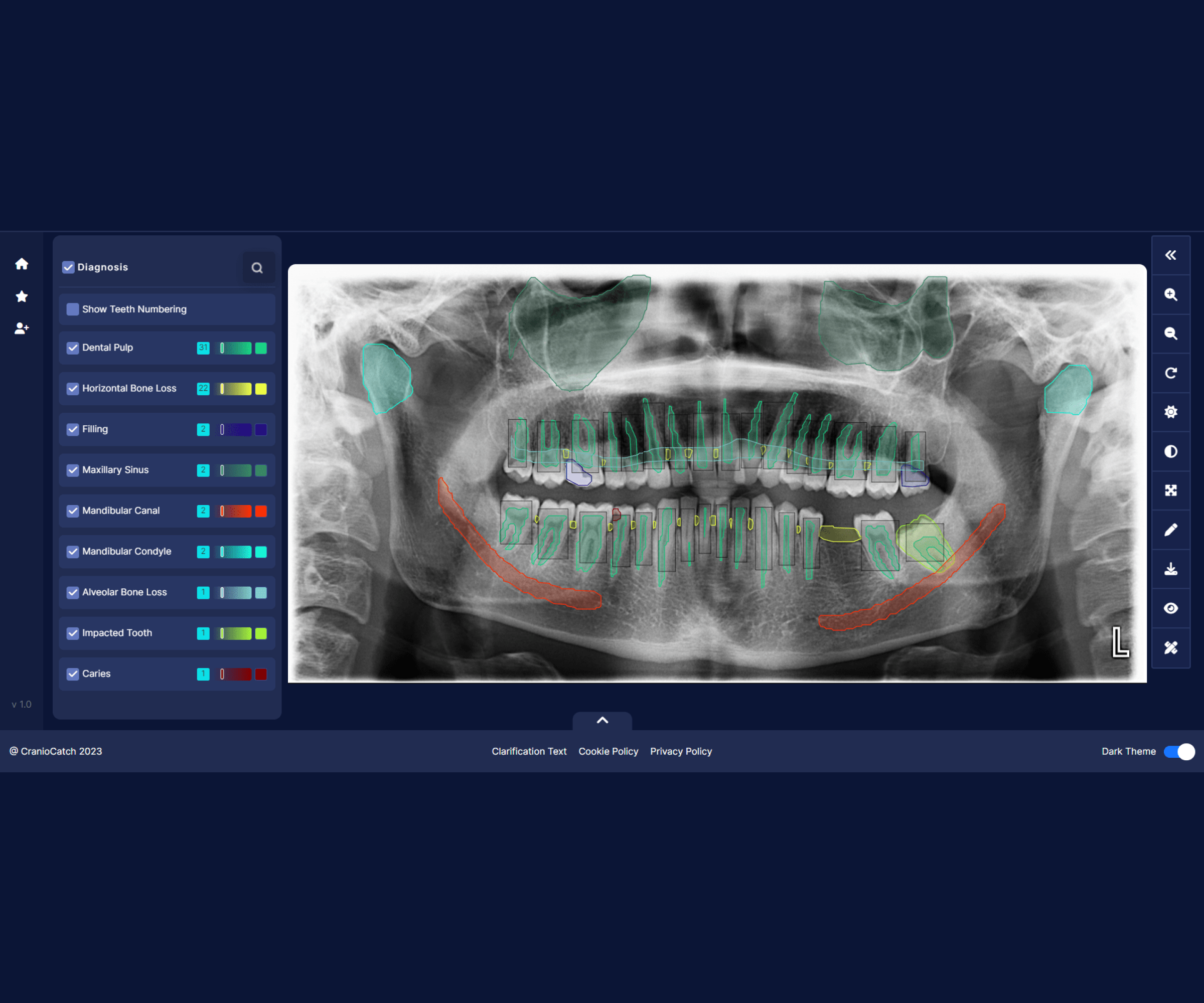CranioCatch will give momentum to dental tourism!