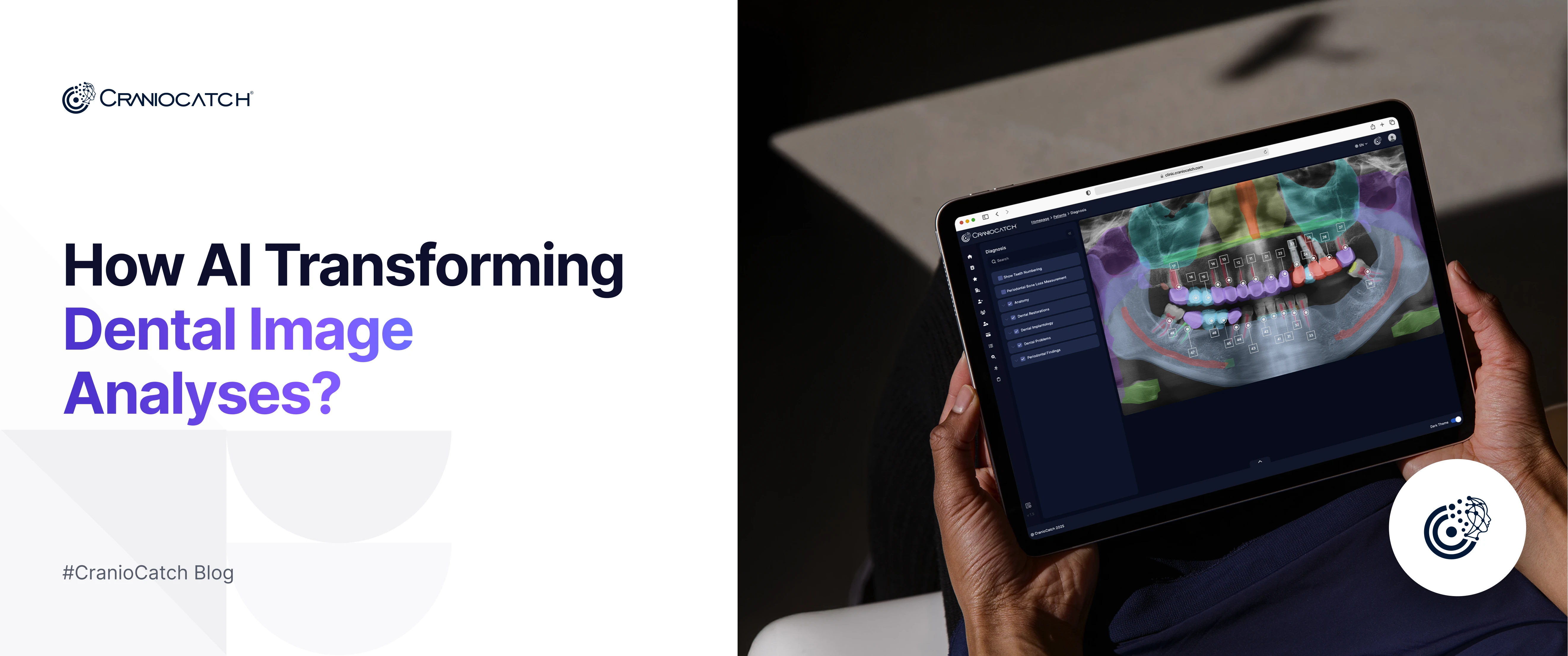 How AI is Transforming Dental Image Analysis: 2026 Guide