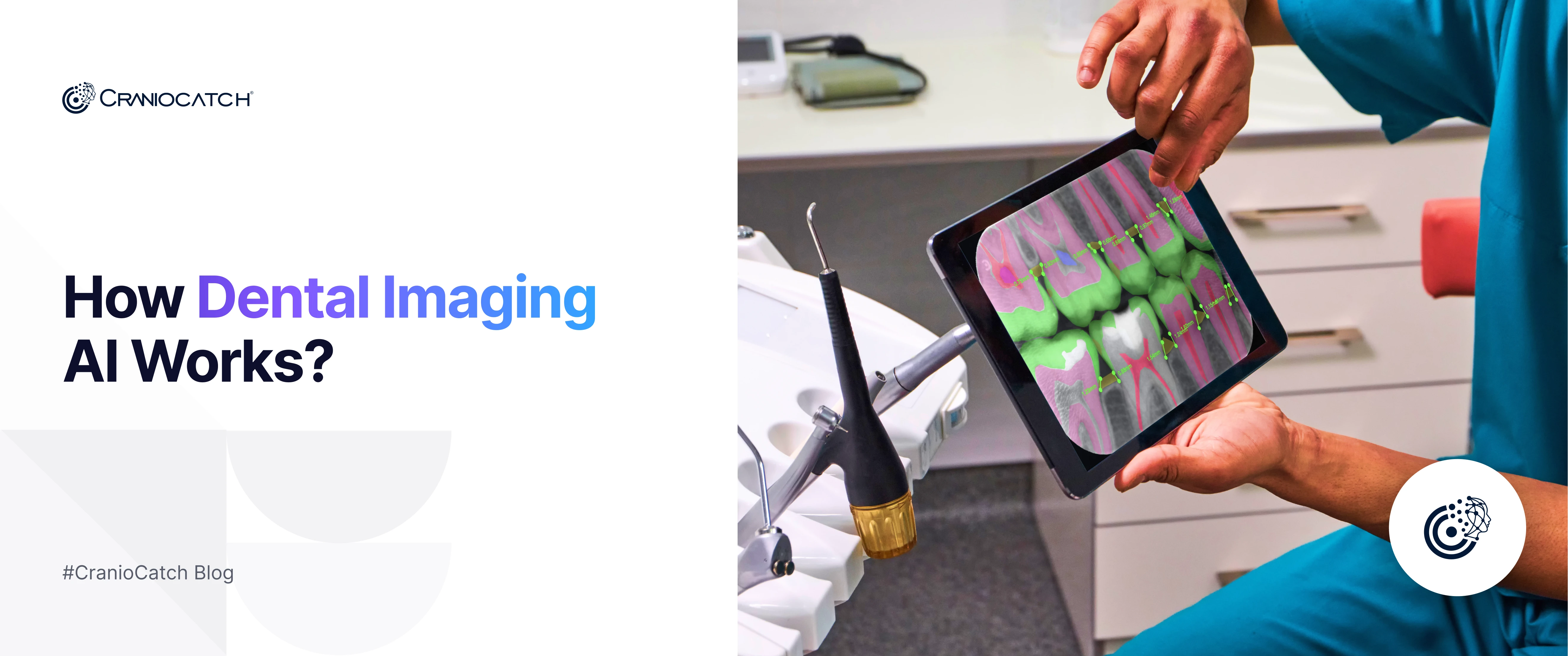 How Dental AI Works: From X-rays to Instant Diagnosis