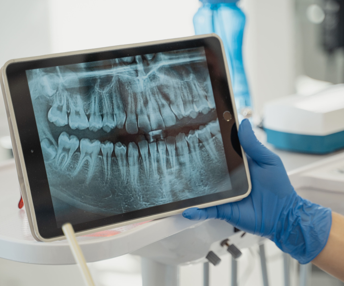Revolutionizing Dentistry: AI-Powered Dental App