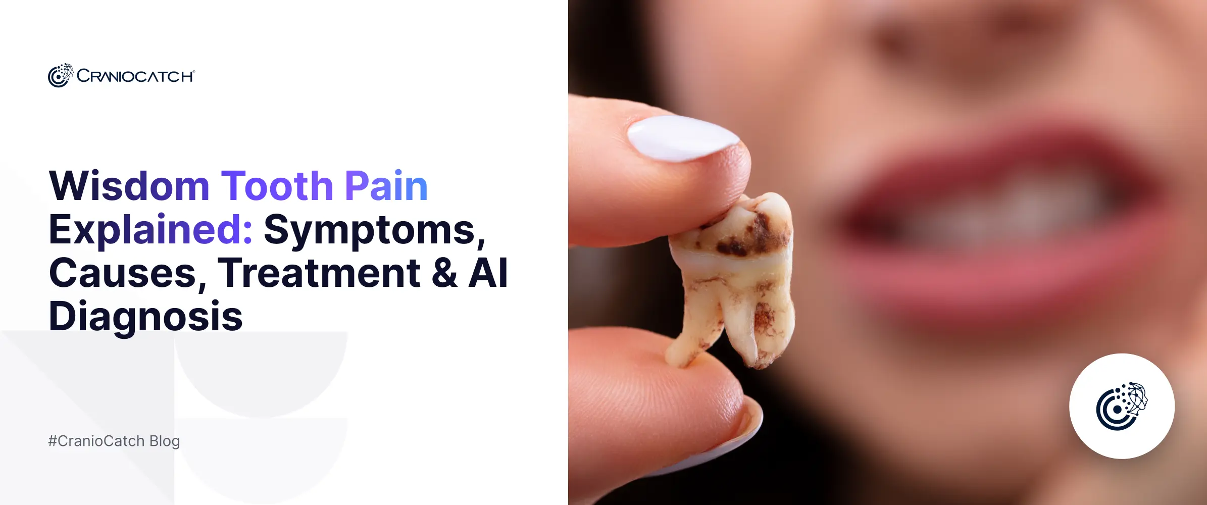 Wisdom Tooth Pain Explained: Symptoms, Causes, Treatment & AI Diagnosis