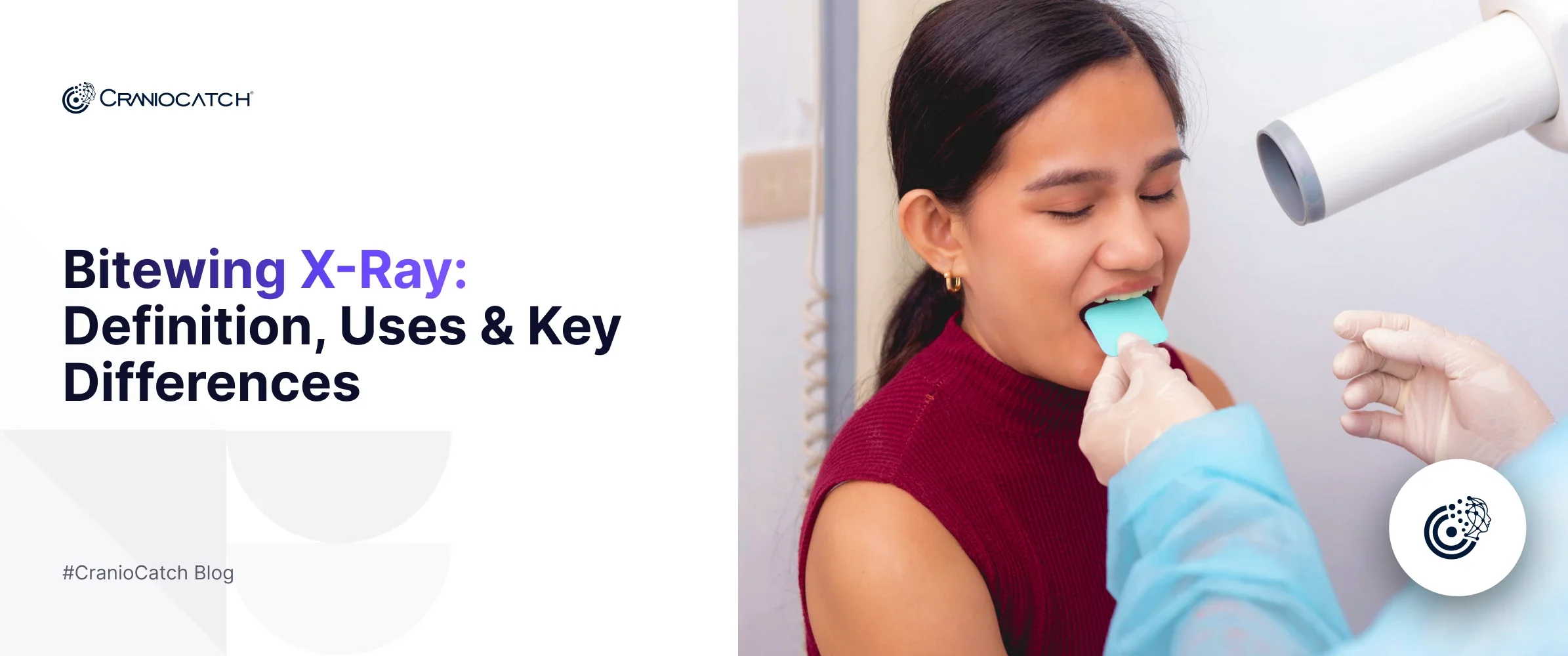 Bitewing X-Ray: Definition, Uses & Key Differences