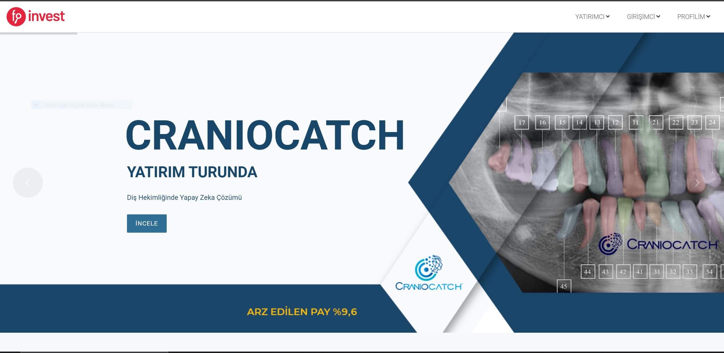 CranioCatch goes on an investment tour with the fund finder...