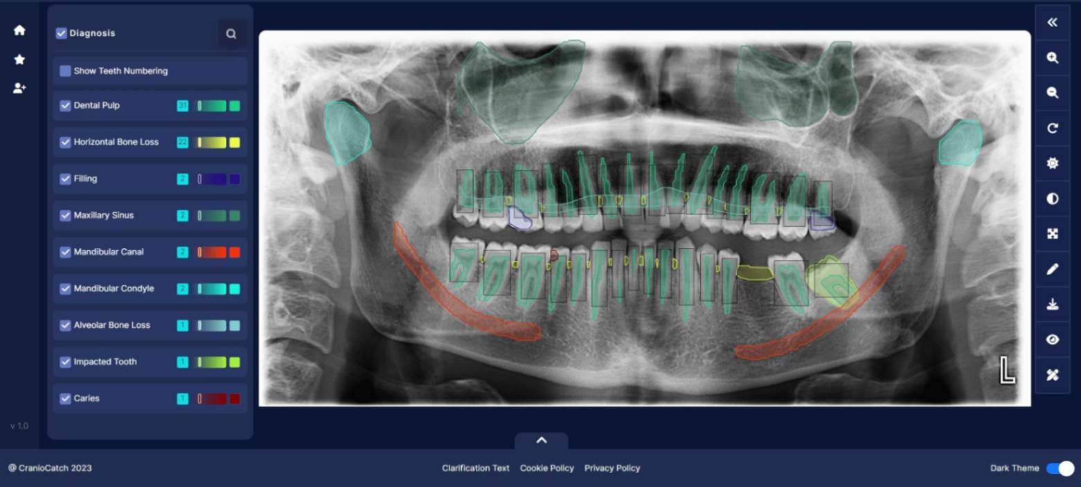 CranioCatch, dental turizme ivme kazandıracak!