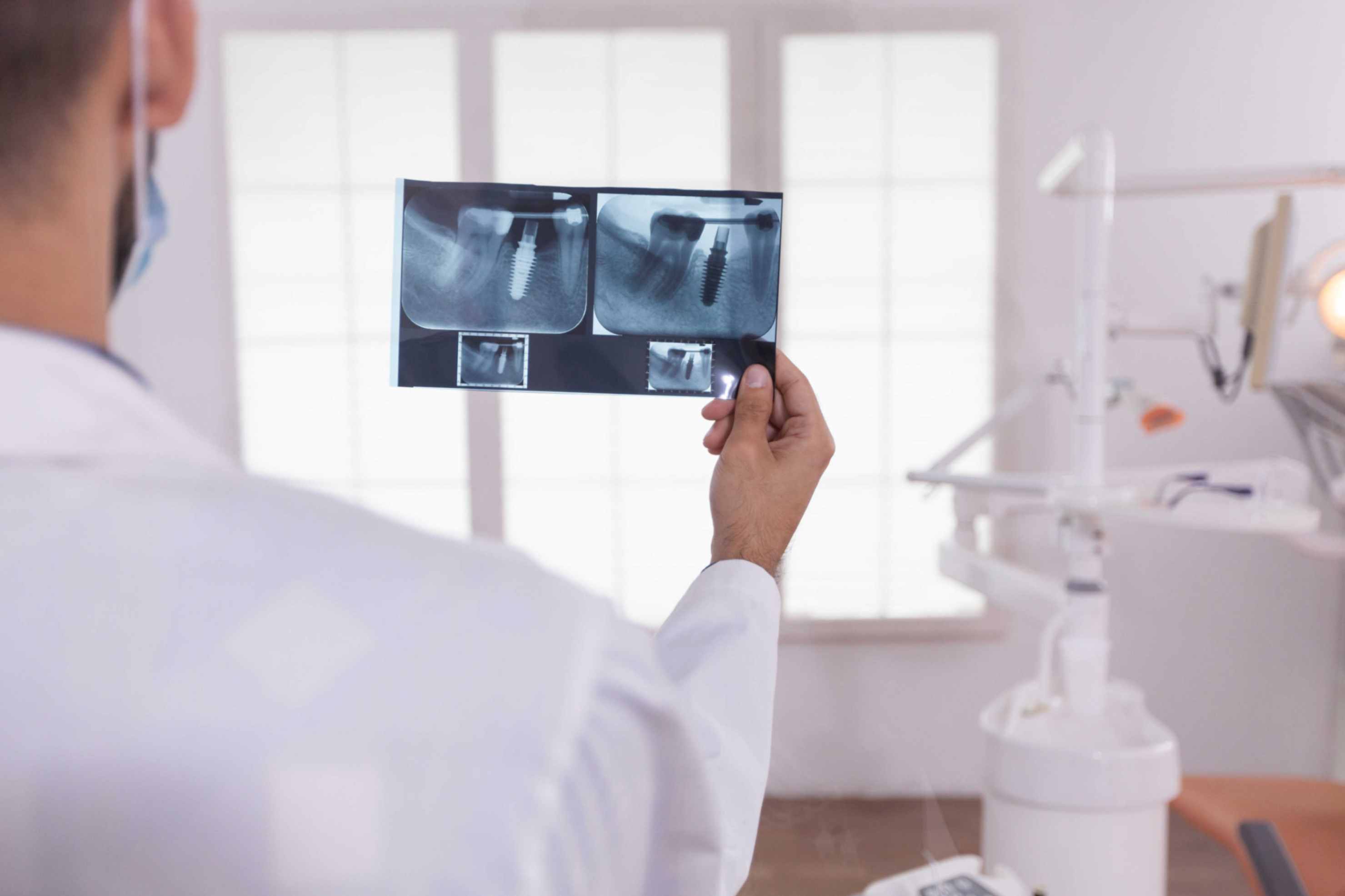 Dental Cone Beam CT Tarayıcı – Daha İyi Teşhis İçin Hassas Görüntüleme