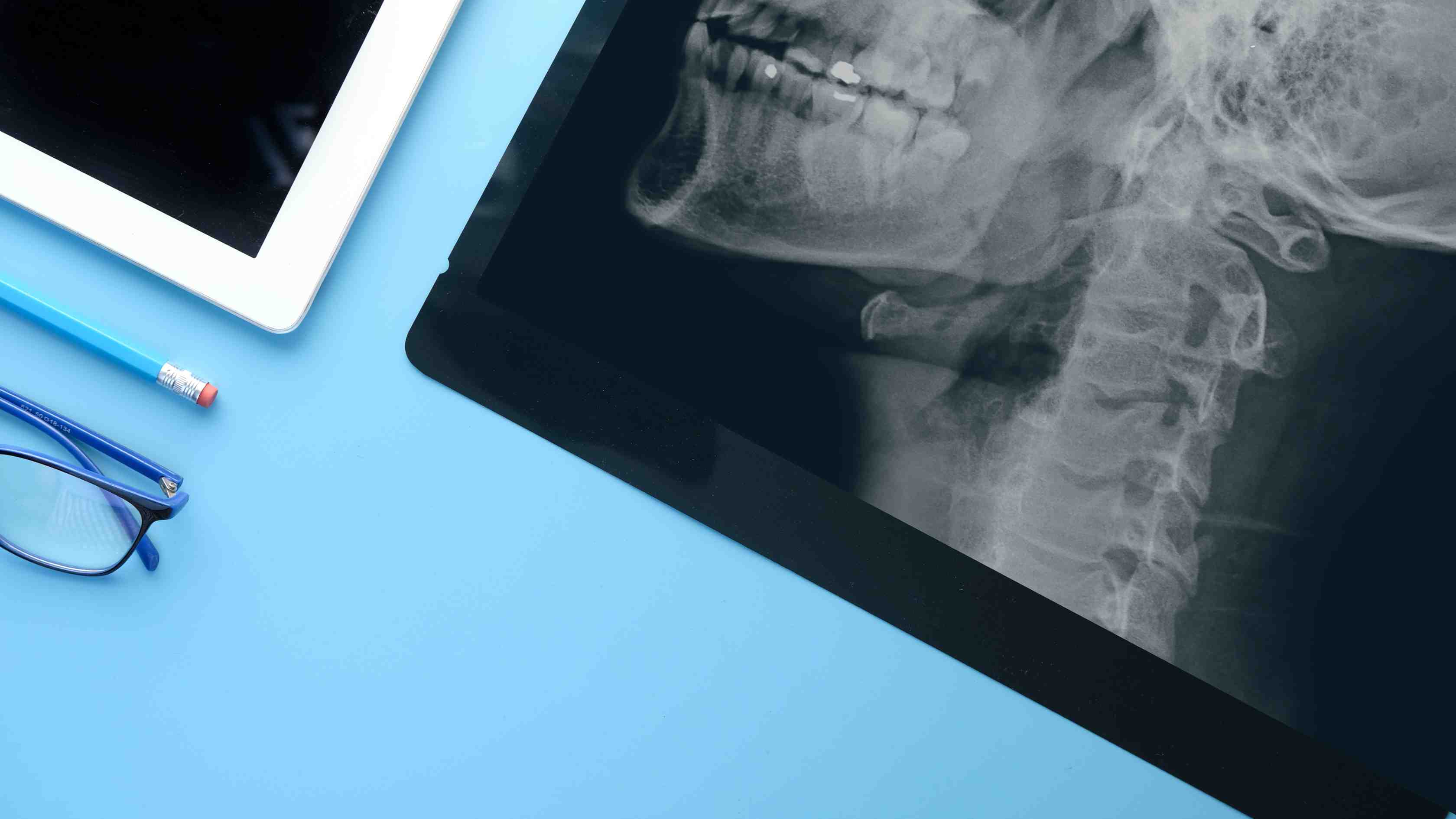 Advanced cephalometric radiography improving orthodontic treatment outcomes