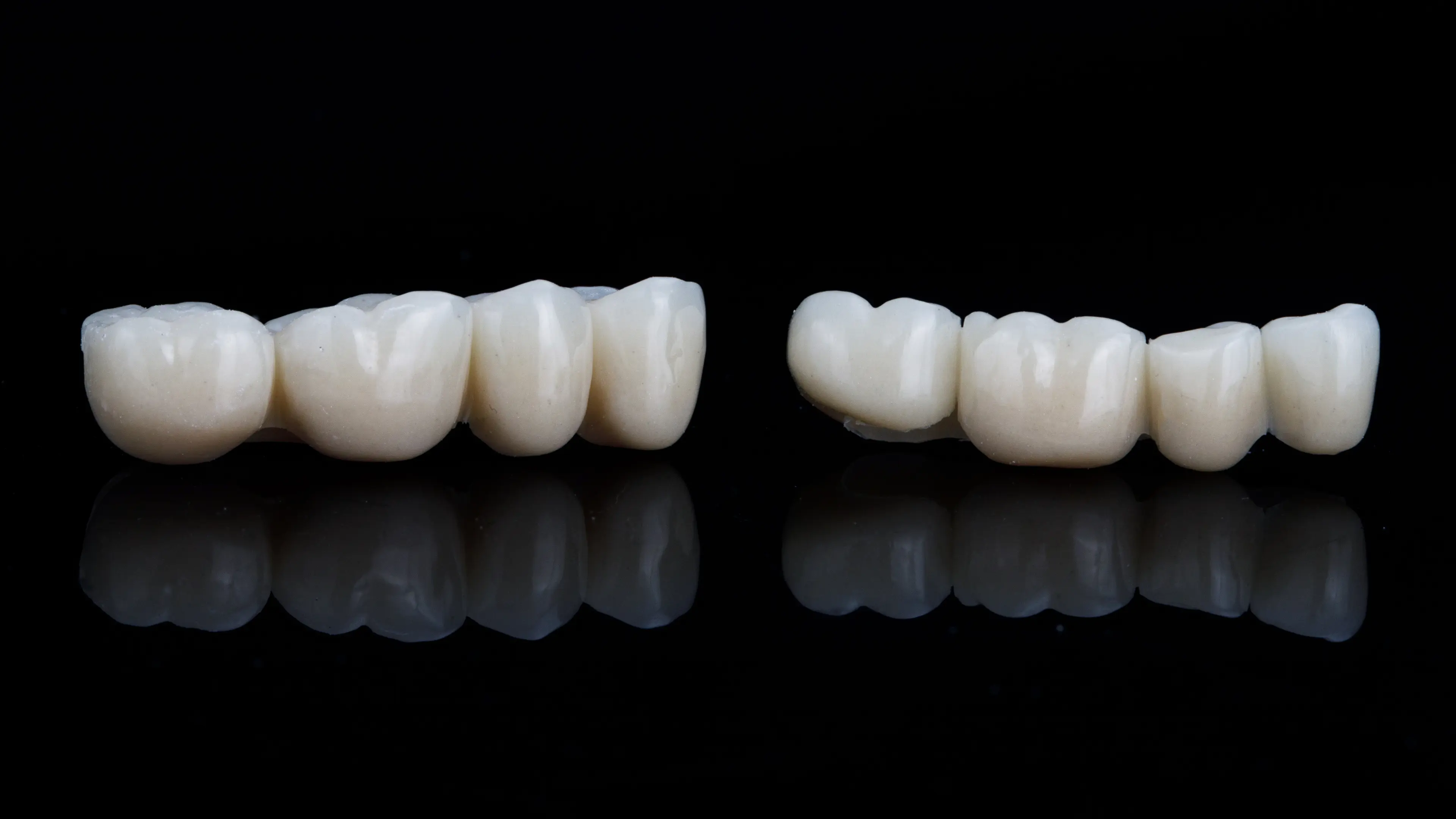 A close-up view of two dental bridges, showcasing a tooth bridge and a single tooth bridge on a reflective black surface, commonly used for bridging a tooth in dental procedures like a dental bridge for one tooth or a front tooth bridge.