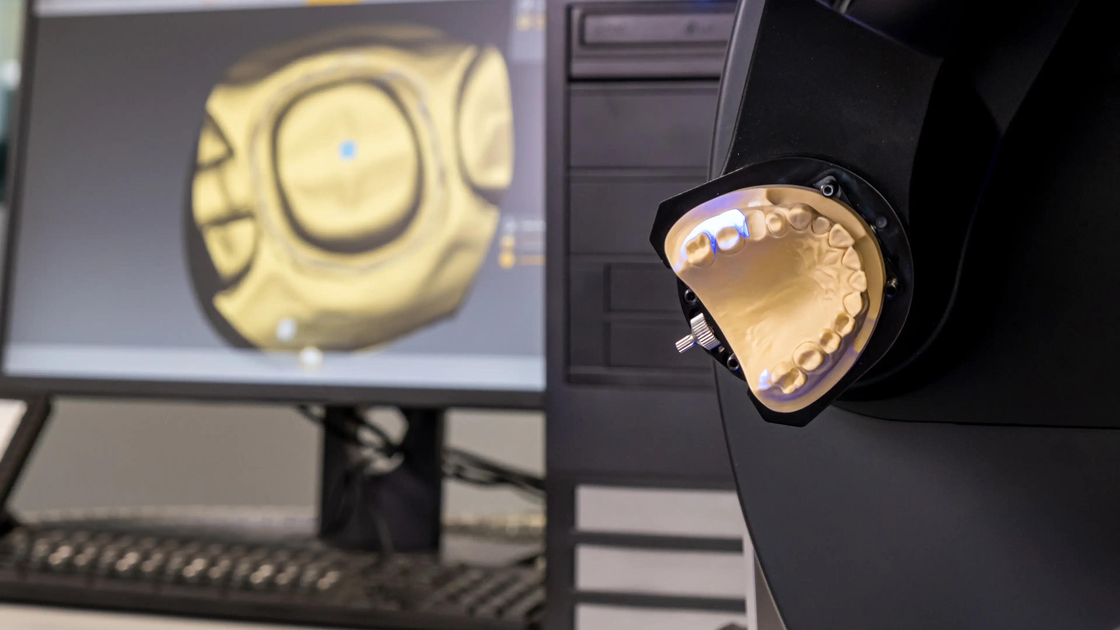 Digital dental crowns provide functional results by offering high precision