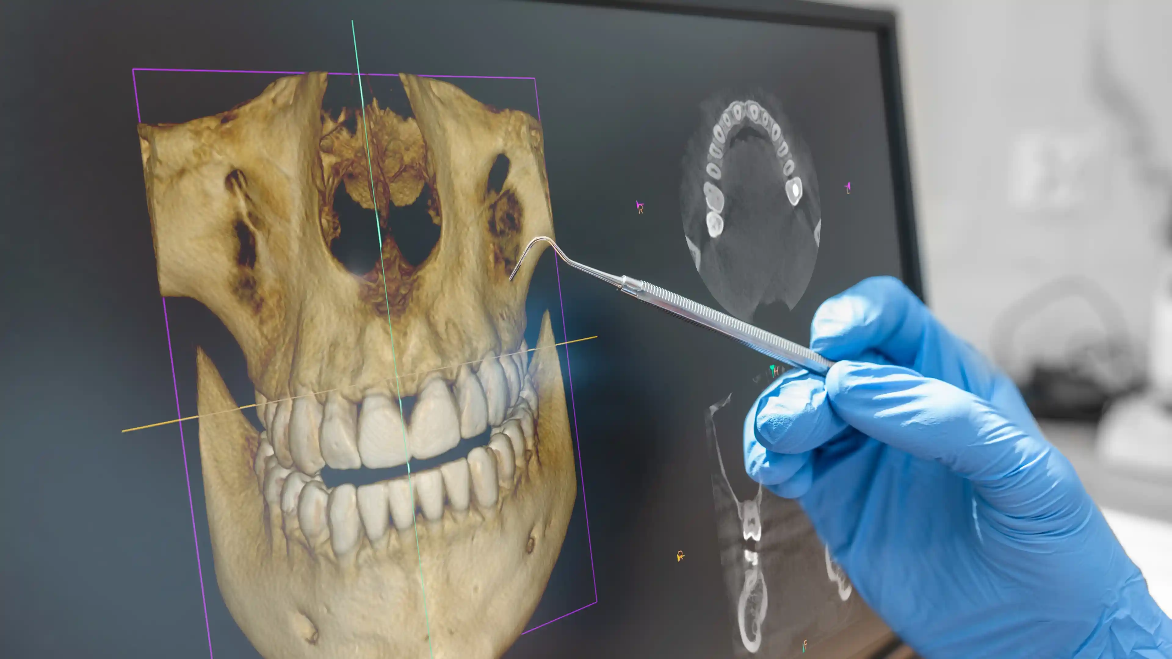 close-up of dental 3D imaging analysis