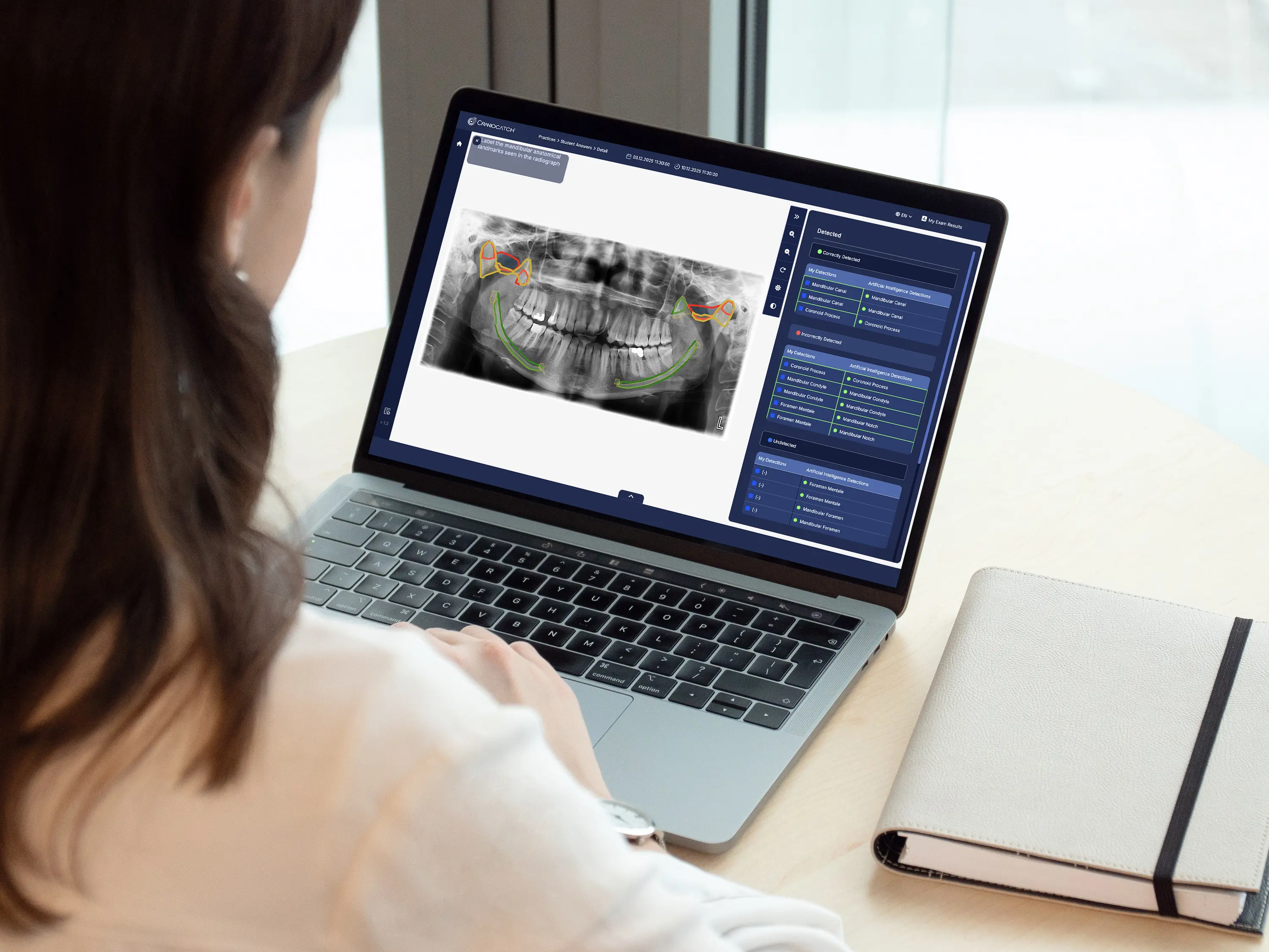 Dental student analyzing colored segmentation of mandibular canals and sinuses on a large monitor during preclinical training.